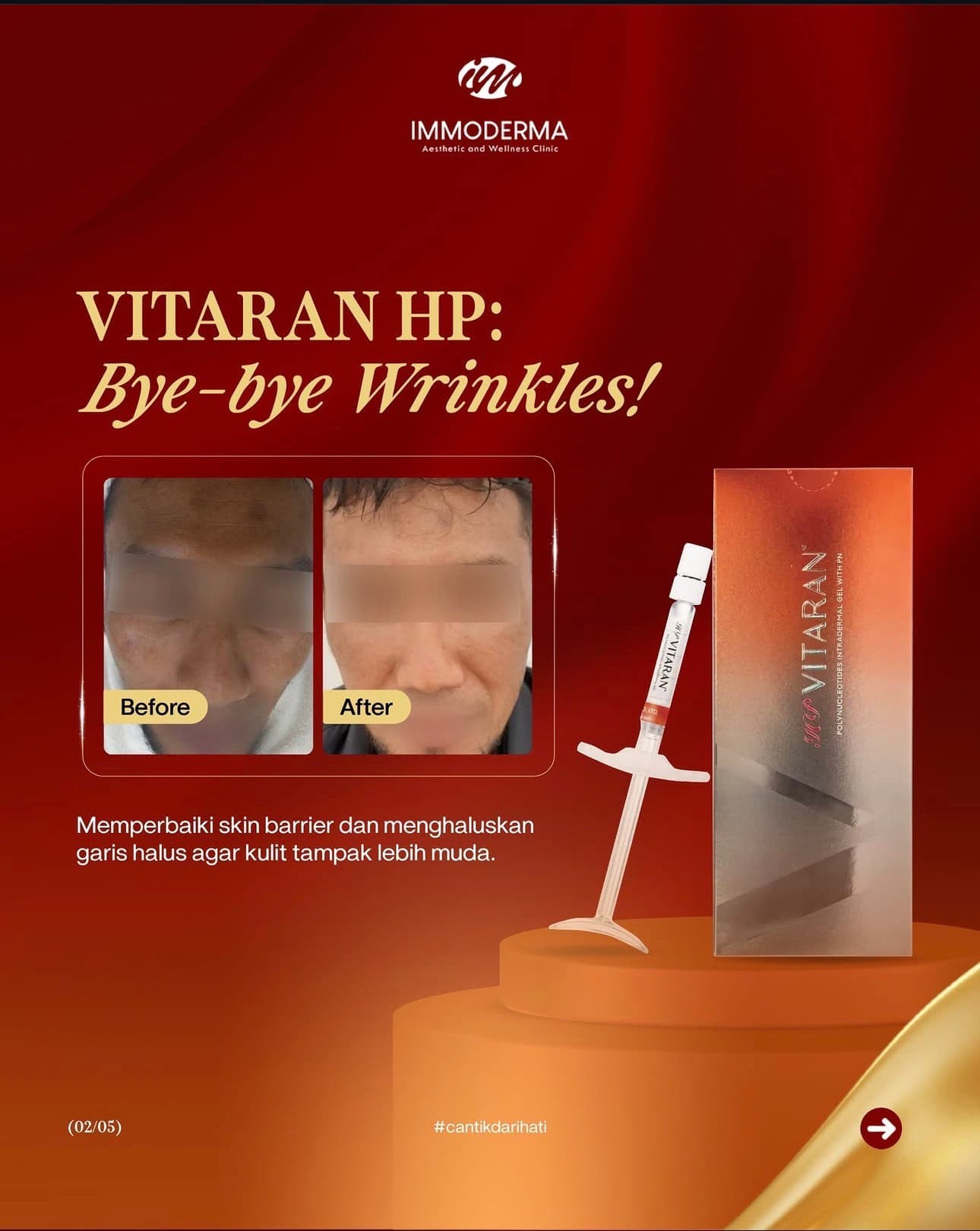 Materi Vitaran HP