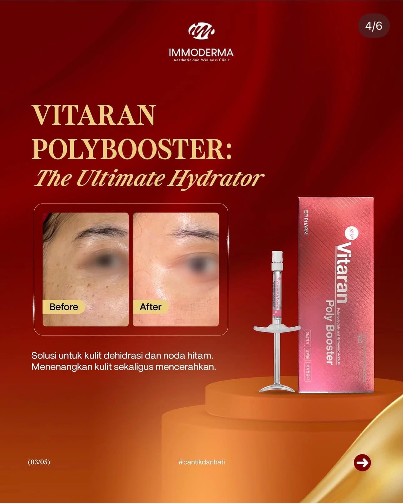 Materi promo Vitaran Polybooster Immoderma untuk hidrasi dan noda hitam