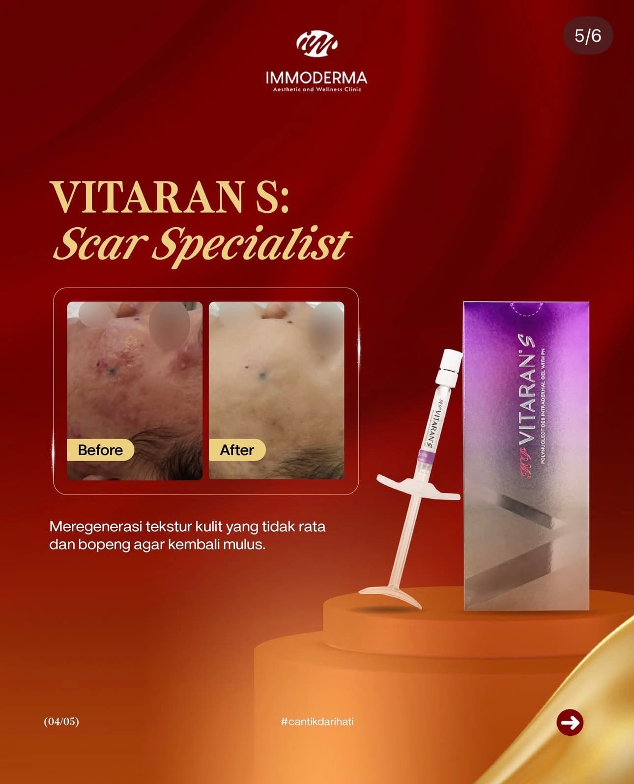 Materi Vitaran S